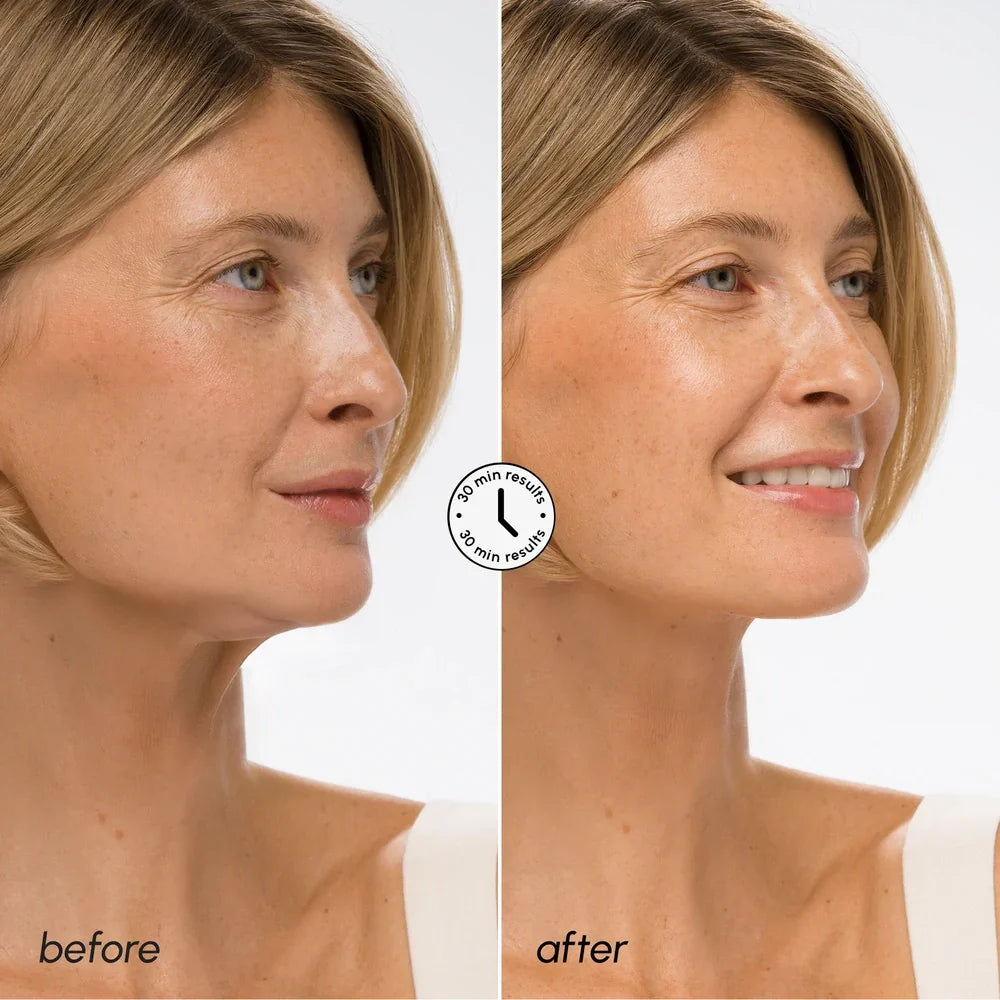 Mascarilla lifting V-line de ácido hialurónico