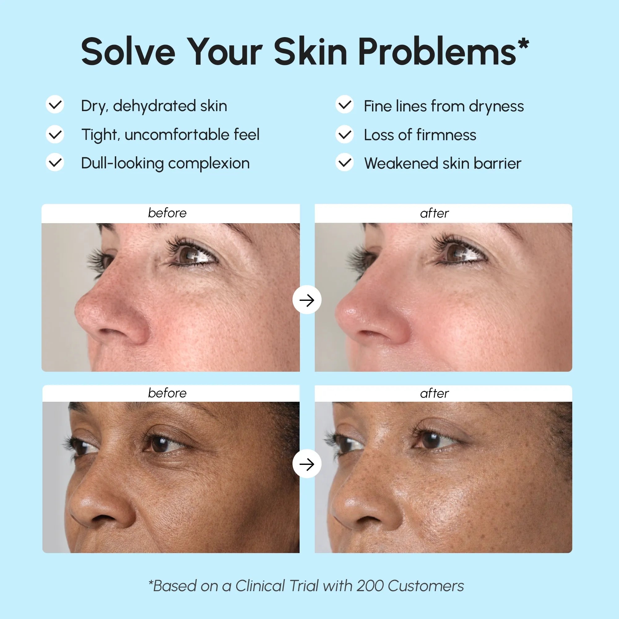 Crema facial de colágeno Ultra Hidratante